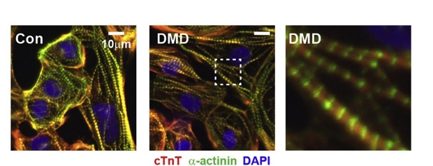 Increased tissue stiffness triggers contractile dysfunction and telomere shortening in dystrophic cardiomyocytes published in Stem Cell Reports